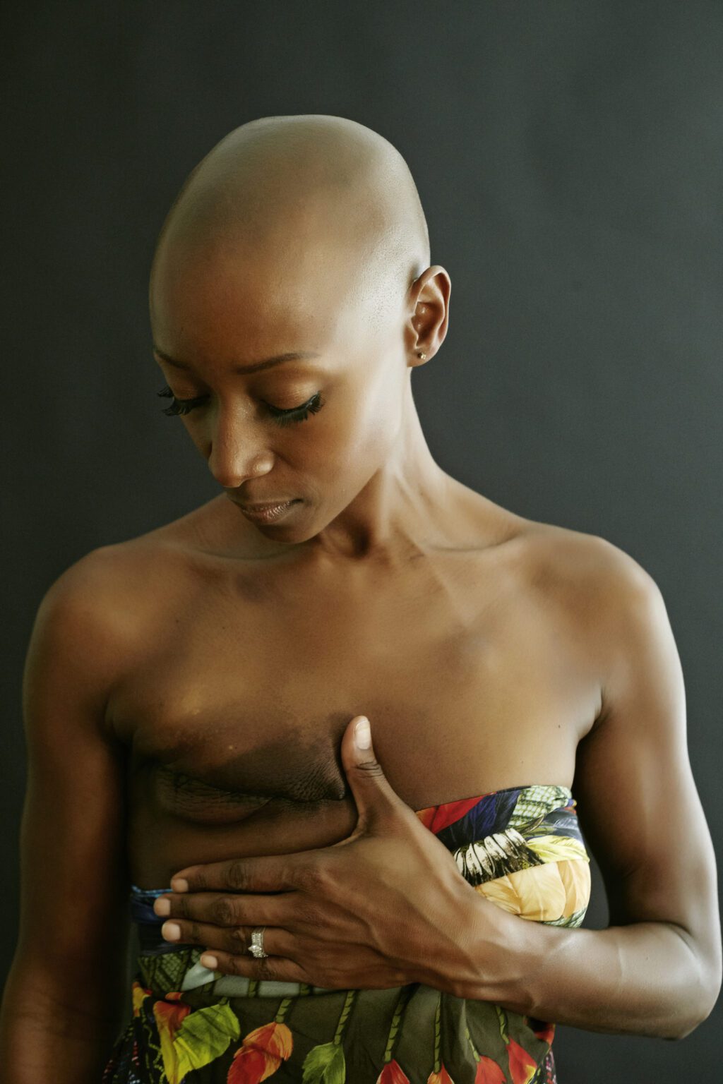 Black woman with a mastectomy scar