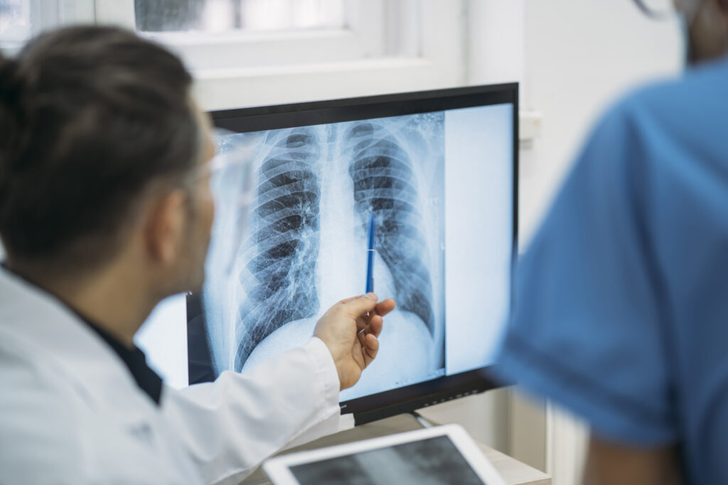 Doctors analysing radiological chest x-ray