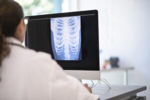A doctor sits at their desk and looks at an x-ray of someone's chest
