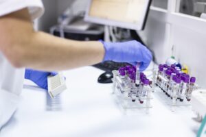 Blood tubes at the microbiology laboratory.