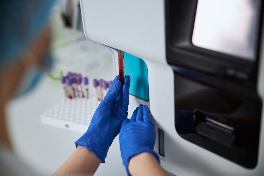 Laboratory technician conducting a biochemical analysis on a hematology analyzer