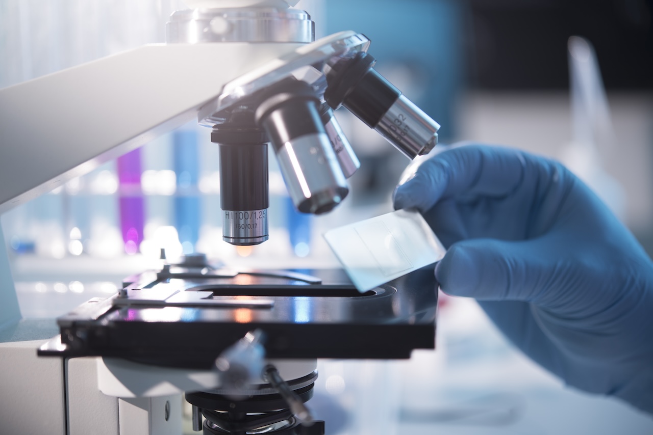 Beyond the diagnosis: The search for new SCLC breakthroughs