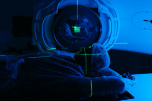 Why most prostate cancer patients have 28 sessions of radiation