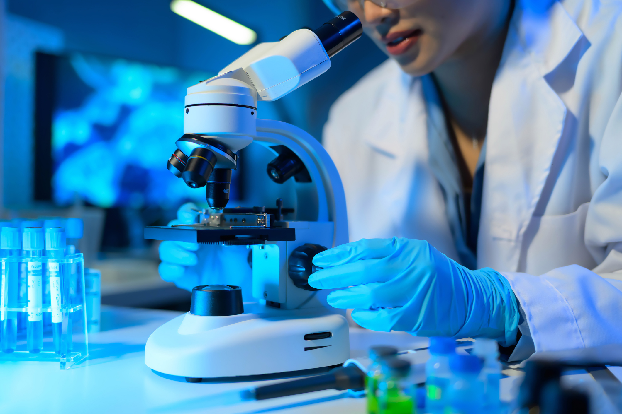 A new urine test could change how bladder cancer is detected and treated