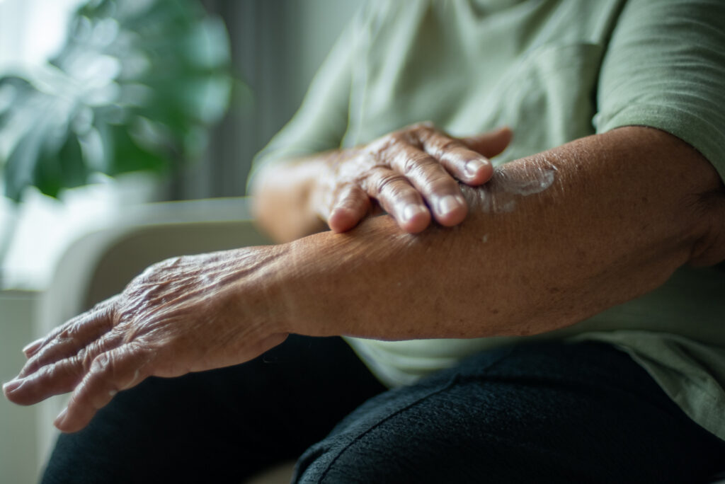 Senior woman applying arm cream.